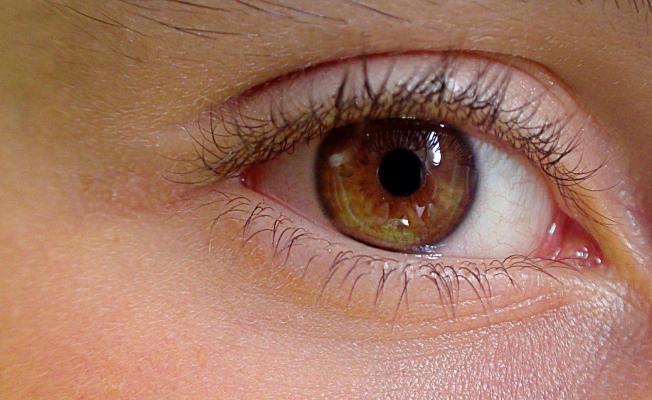 Akıllı lens tedavisinde göz yapısı uygunluğu çok önemli
